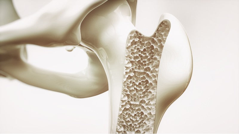 Bone Health and Osteoporosis